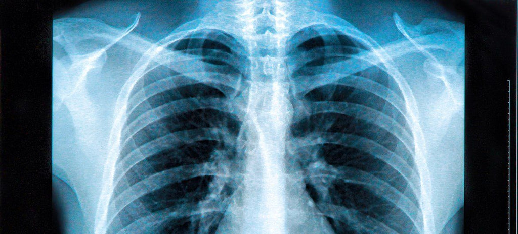 Are you a likely target for cancer? How to tell