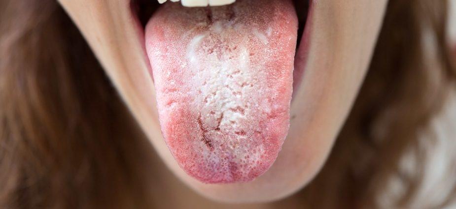 Fatigued? Always sick? Moody? This may be why