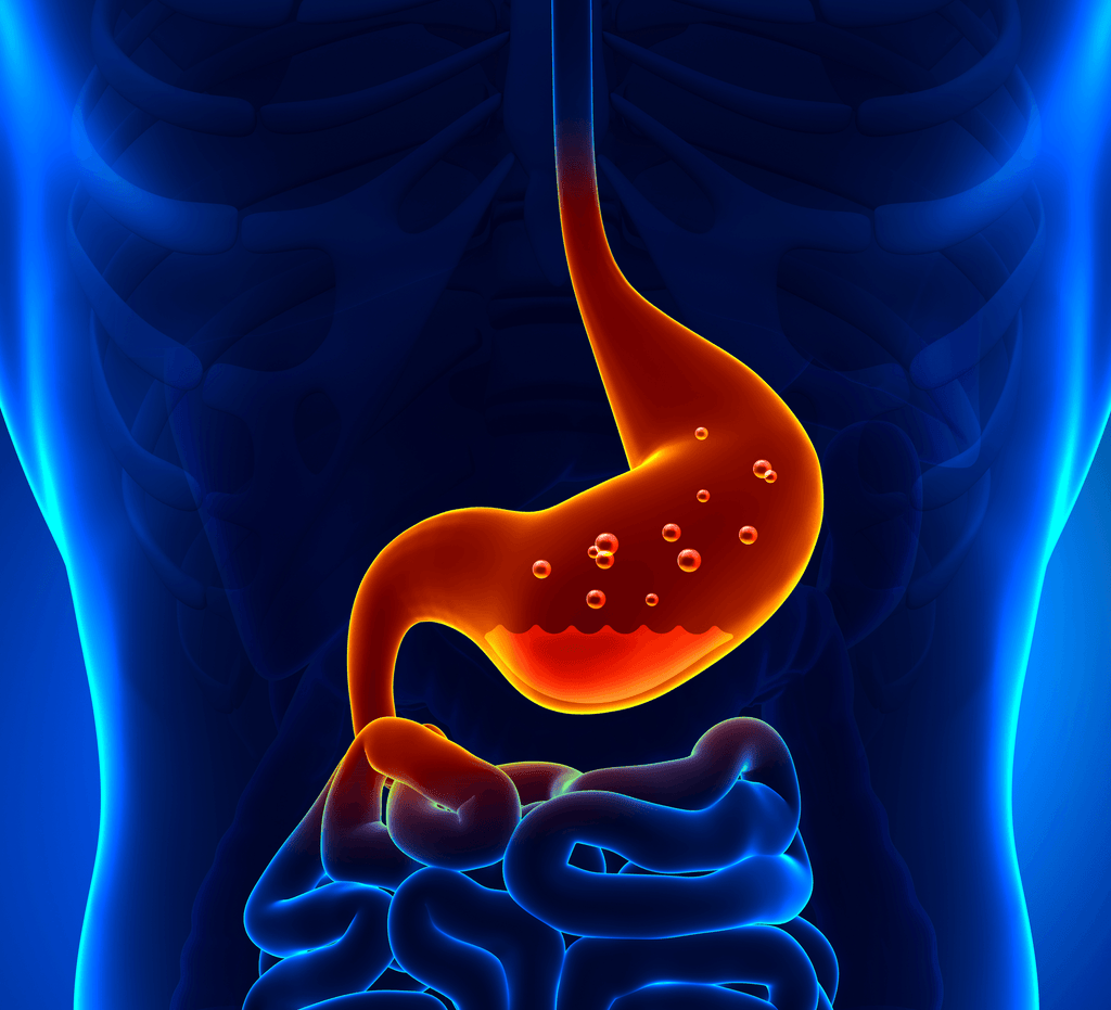 When acid reflux turns to cancer
