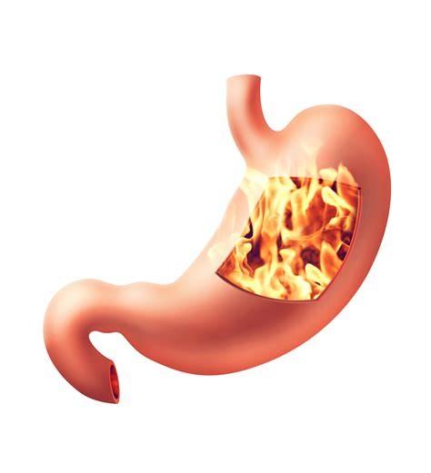 Get relief from your gut aches