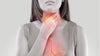 Did you know about this hidden danger of acid reflux?