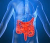 Unraveling the mystery of colitis and Crohn’s