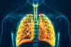Recovered from COVID? How to heal your lungs!