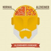 What you must know about Alzheimer’s