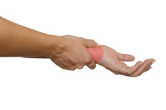 Carpal tunnel relief—without surgery or steroids!