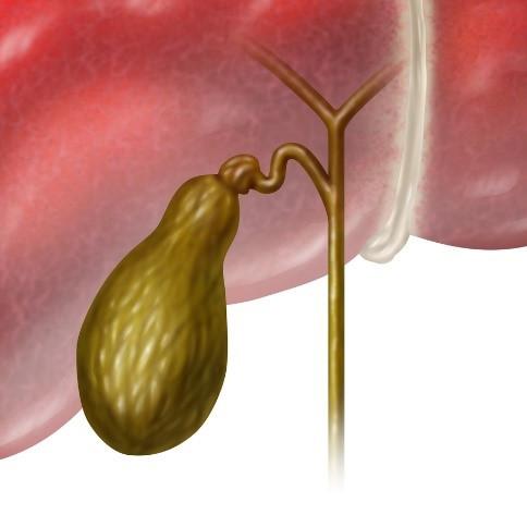 How not to lose your gallbladder (and what to do if you already have)