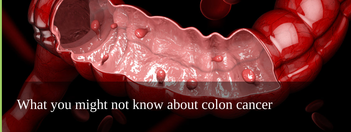 What you might not know about colon cancer